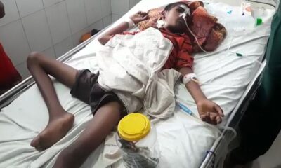 Teen eats 16 Toothbrushes, Iron Nail to Combat Soil Eating Habit