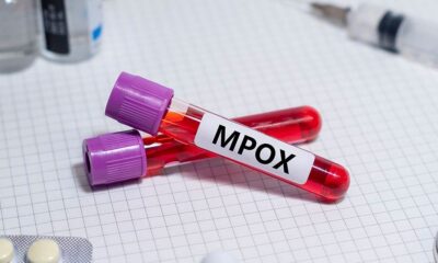NCDC reports higher Mpox infection among males in Nigeria