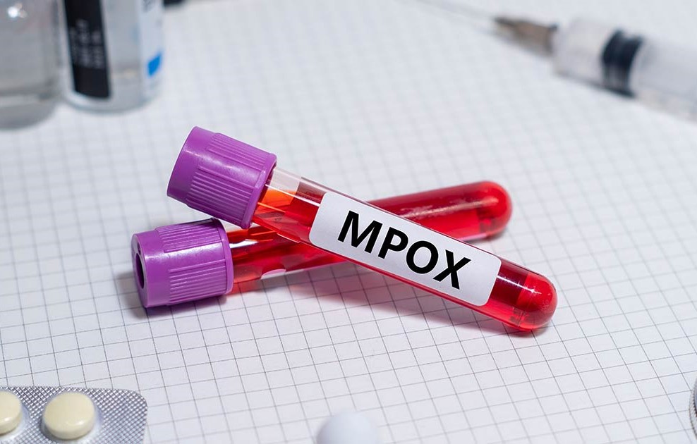 NCDC reports higher Mpox infection among males in Nigeria